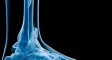 Foot X-Ray