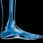 Barefoot Running and Minimalist Shoes